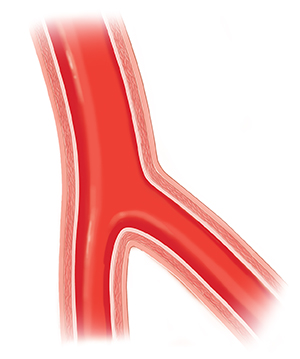 Cross section of healthy artery.