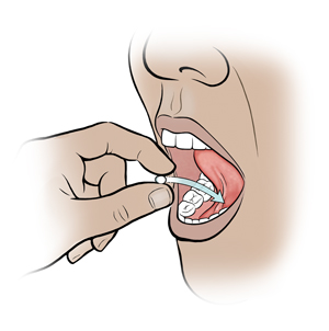 Close-up of mouth showing fingers placing pill under tongue.