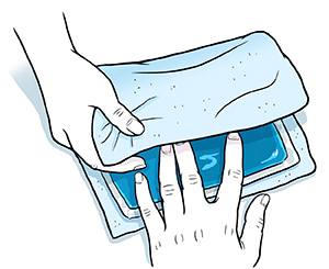 Wrap the cold source in a thin towel before using it.