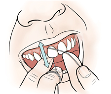 Primer plano de una boca donde pueden verse manos que pasan el hilo dental entre los dientes del frente.