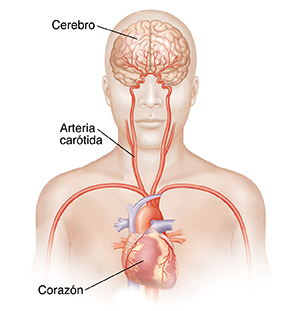 Vista frontal de la cabeza y la parte superior del cuerpo que muestra las arterias carótidas y el cerebro.