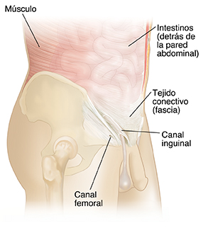 Vista lateral del torso de un hombre donde pueden verse los músculos abdominales y los intestinos en imagen fantasma. Se ven el anillo umbilical y el anillo inguinal interno.