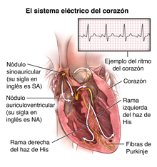 Corte transversal del corazón que muestra las vías de conducción eléctrica y el ritmo normal del corazón